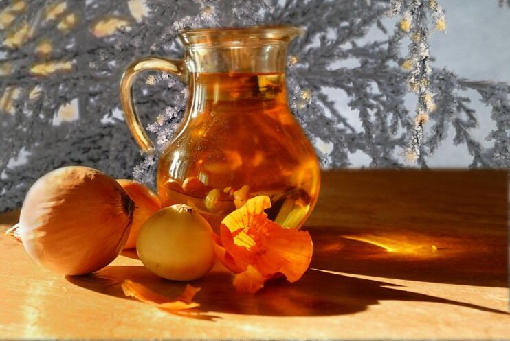 decokcija čebule za prostatitis